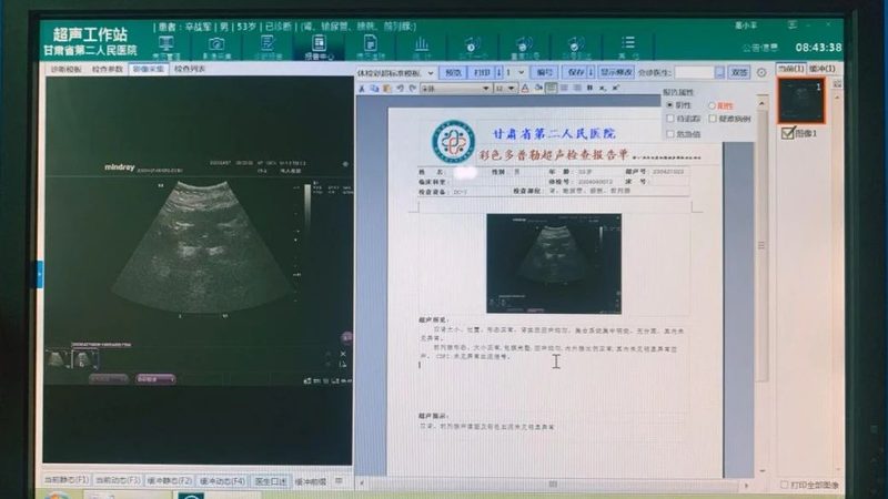 肿瘤标志物检查，多久出结果？**